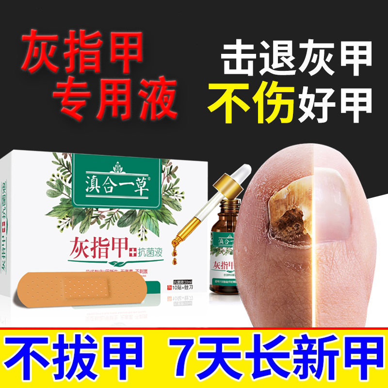 【厂家直降】灰指甲抑菌护理液