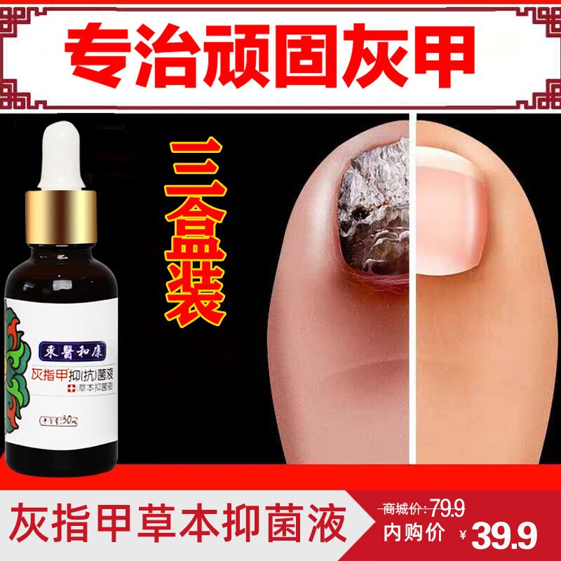 【专营店】東醫和康 修复灰指甲3盒装