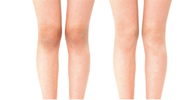 liberta白姬关节膝盖美白褪黑去角质磨砂霜50g