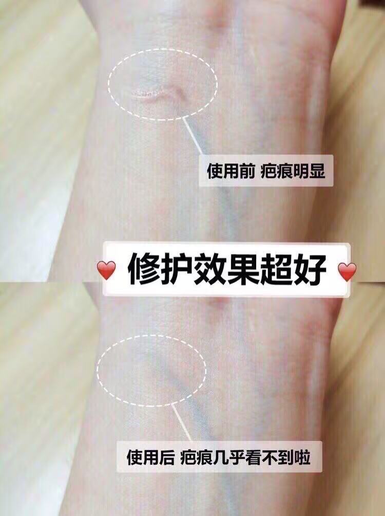 0_2